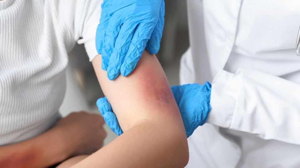 A patient with an injured arm is treated by a doctor.