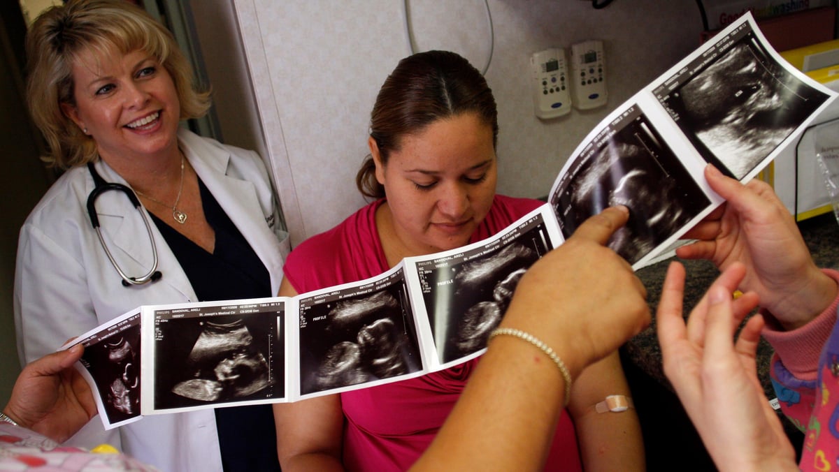 Nurses point to ultrasound pictures. 
